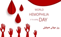  در روز جهانی هموفیلی با این بیماری بیشتر آشنا شوید!